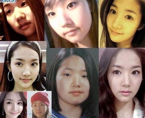 Cắt mí mắt là một trong những ca phẫu thuật phổ biến nhất Hàn Quốc. Thậm chí đây còn là phần thưởng nhiều gia đình dành cho con em khi đến tuổi trưởng thành.